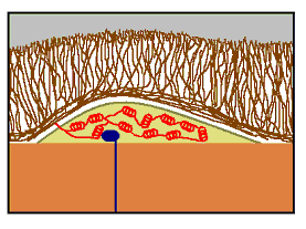 diagram: Septobasidium