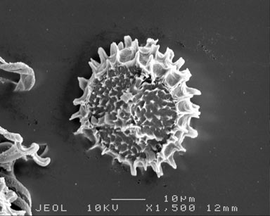 APII jpeg image of Fossombronia cultriformis  © contact APII