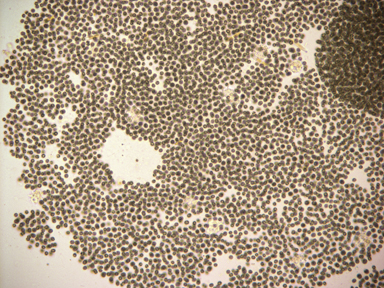 APII jpeg image of Microcystis aeruginosa  © contact APII