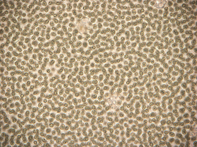 APII jpeg image of Microcystis aeruginosa  © contact APII