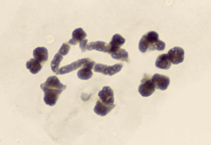 Chromosomal studies in Viscum